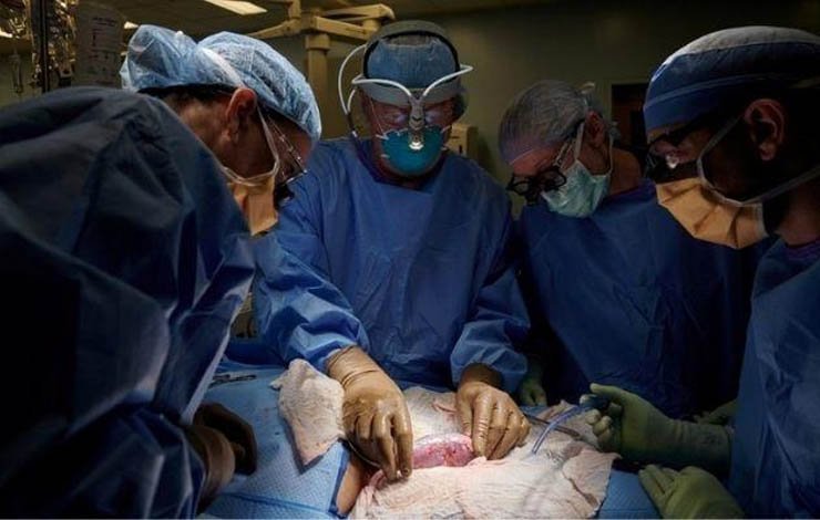 Pig kidney transplanted into human body