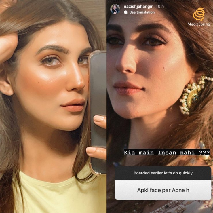 Nazish Jahangir, acne-shaming, moles