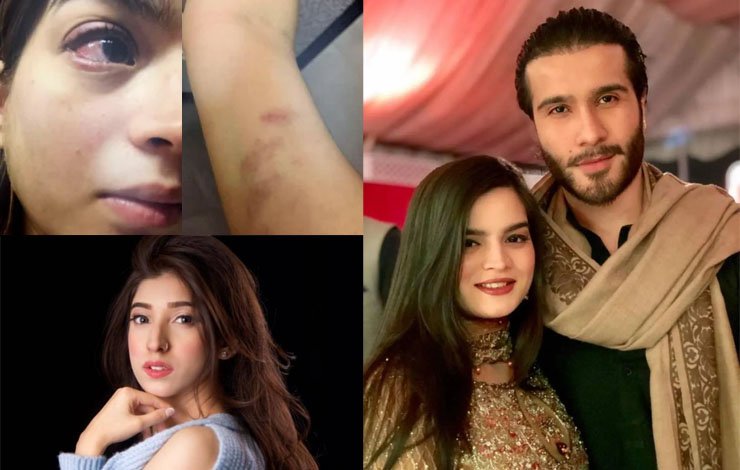 pictorial avidance of tortutre on aliza sultan, فیروز خان