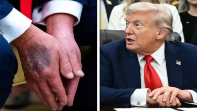 Photo of ’میں نے زندگی میں کبھی اچھا محسوس نہیں کیا،‘ ڈونلڈ ٹرمپ کا اپنی صحت سے متعلق افواہوں پر ردعمل